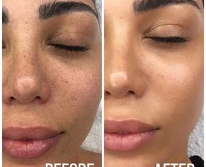 BB Glow Facial
