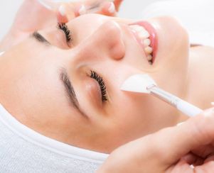 Chemical Peel