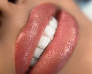 Dark Lips Correction/Neutralization