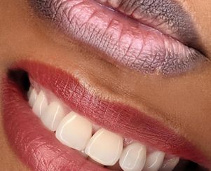 Dark Lips Correction/Neutralization