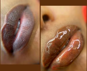 Dark Lips Correction/Neutralization