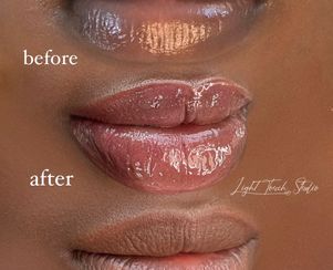Dark Lips Correction/Neutralization