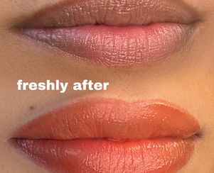 Dark Lips Correction/Neutralization