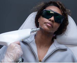 laser hair removal for all skin types