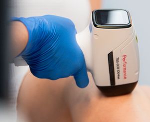 Laser Hair Removal