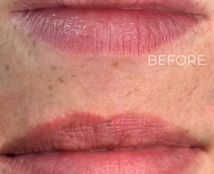 Lips Blush
