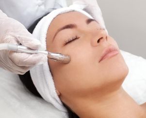 Microdermabrasion