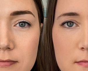 Nano Eyebrows/Nanoblading