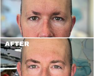 Nano Eyebrows/Nanoblading