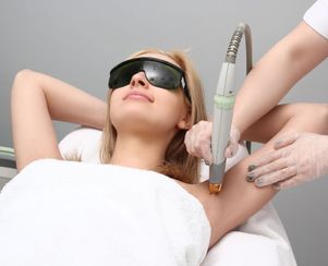 Nd:yag Laser Hair Removal