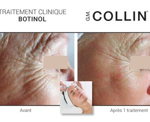 Soins visages québécois personnalisés